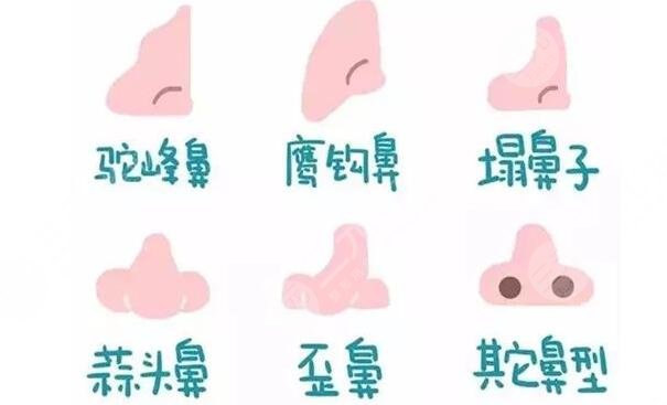 北京世纪坛医院整形外科隆鼻案例