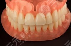 隐形牙一颗多少钱？费用价格表参考！2022牙齿修复指南~