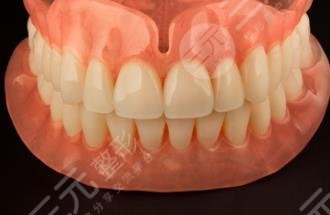隐形牙