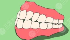 假牙的种类及价格详细介绍！种牙or活动假牙？分享牙齿修复建议~