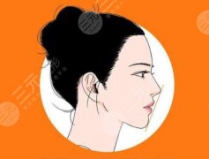 隆下巴哪种方法好？3种常用材料为你介绍，术前必看指南+1！
