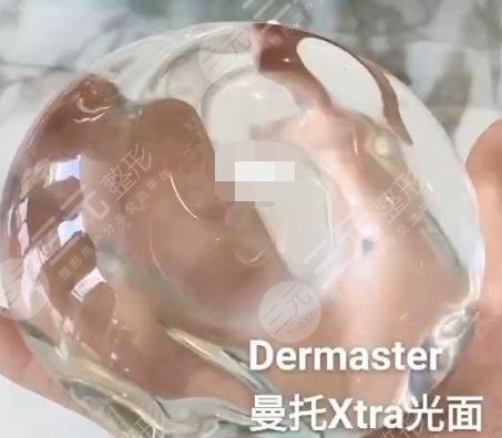 曼托