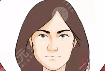 颧骨突出