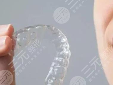 隐形牙套