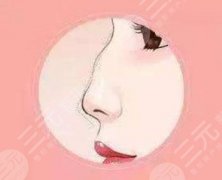 驼峰鼻怎么改良？2种医美方法去掉“颜值bug”！