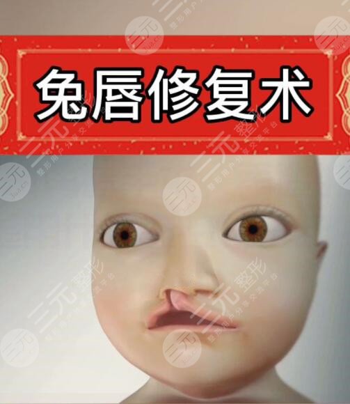 唇裂能修复到完全正常吗？术后注意事项？怎么处理比较好？