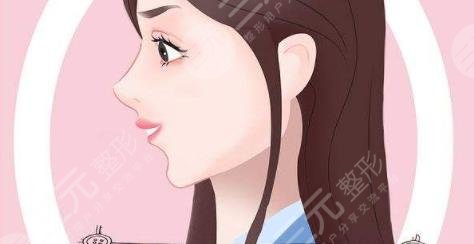 垫下巴