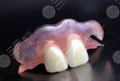 假牙哪种好？3种假牙&不同材质科普，牙齿修复必看知识！