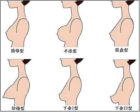 乳房提升棒棒糖切口跟双环切口区别科普！矫正胸部下垂，让你“挺美”！