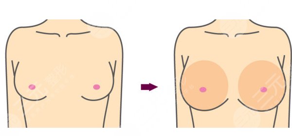 魔滴和曼托怎么选择？魔滴和曼托的区别有哪些？