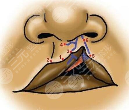 兔唇手术大概需要花费多少元？缓解兔唇大约的费用是多少钱？价格表