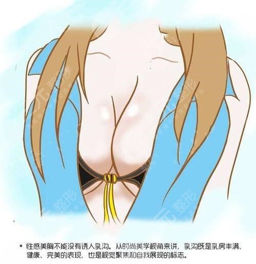 康宁假体和曼托假体哪个好?哪个手感好?康宁假体是国产还是进口?