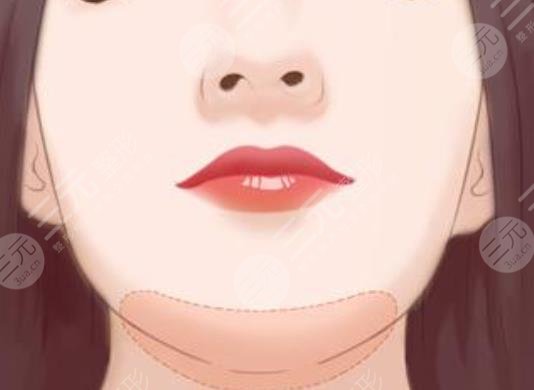 垫下巴
