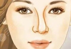鼻子歪了手术一般多少钱？歪鼻矫正价格参考，重塑挺鼻！