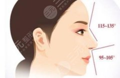 鼻子歪斜怎么矫正,注意事项有哪些?科普助力你搞定歪鼻! 鼻子歪斜怎么矫正,注意事项有哪些?科普助力你搞定歪鼻!