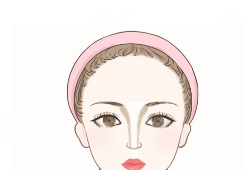 自体脂肪丰额头高吗