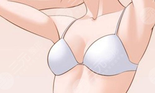 乳房整形