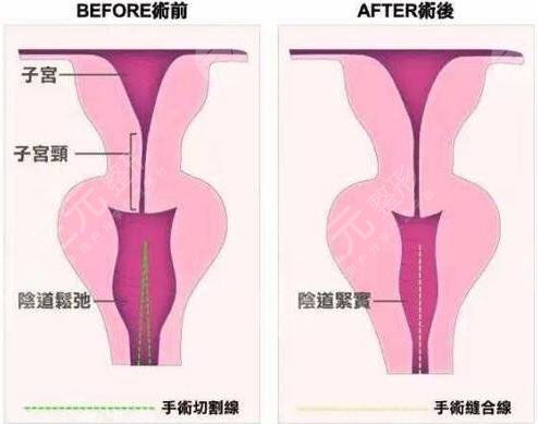 八大处李峰永医生擅长项目介绍