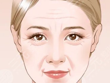 射频除皱手术有哪些注意事项?