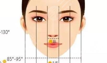 全切双眼皮案例