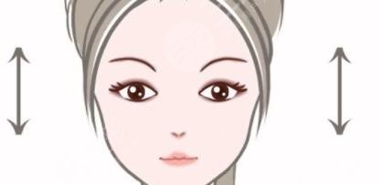 全切双眼皮案例