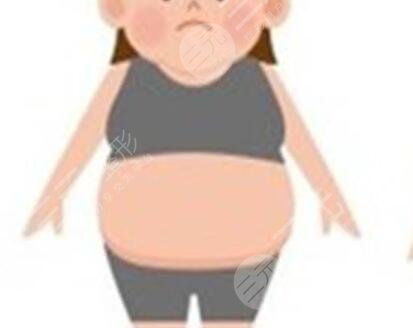 北京东方和谐医疗大腿吸脂案例