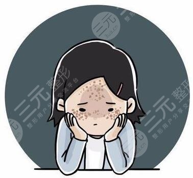 飞梭镭射去痘坑记录