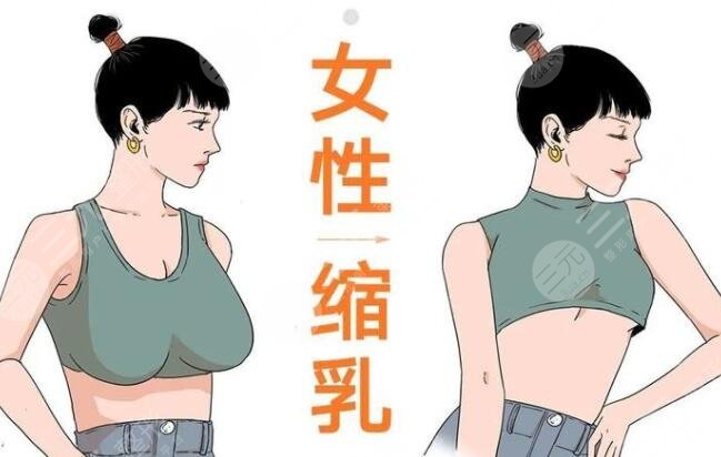 棒棒糖缩胸手术多少天完全消肿？