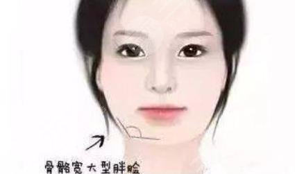 磨骨