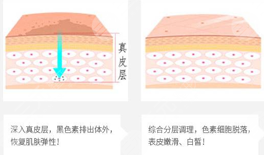 像素激光优势盘点
