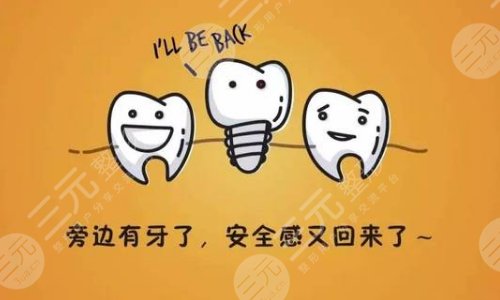 口腔问答二:种植牙过程要多久呢?