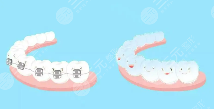 广州春芽口腔医院牙齿矫正前