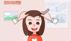 上海碧莲盛微创植发术后108天，美美哒发型get！