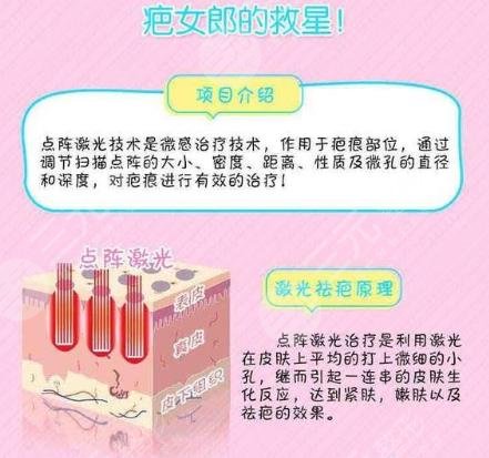 深圳激光去疤痕有吗?