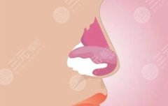 鹰钩鼻可以整形吗？手术方法&术后事项超全资料，助力你重塑美鼻！