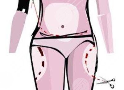 吸脂