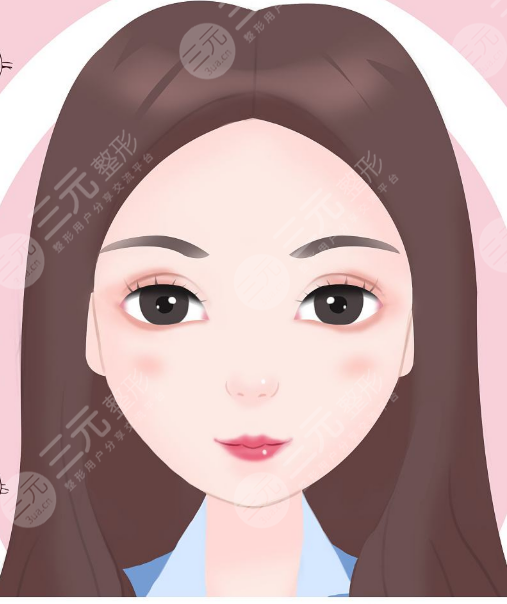 去眼袋案例