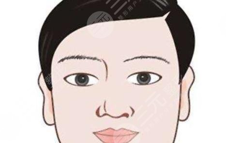 整形
