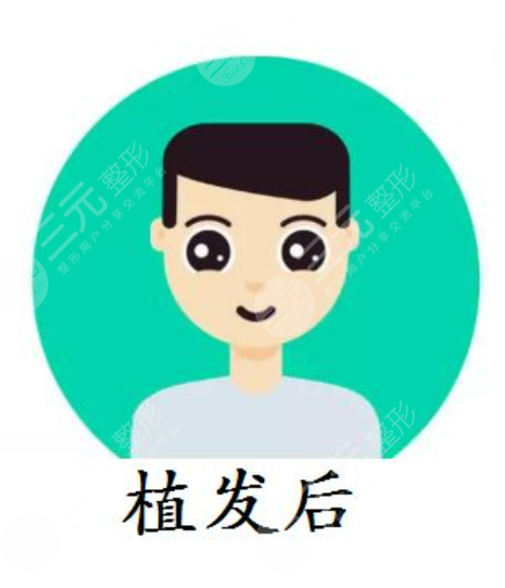 重庆新生植发医院术后体验评价