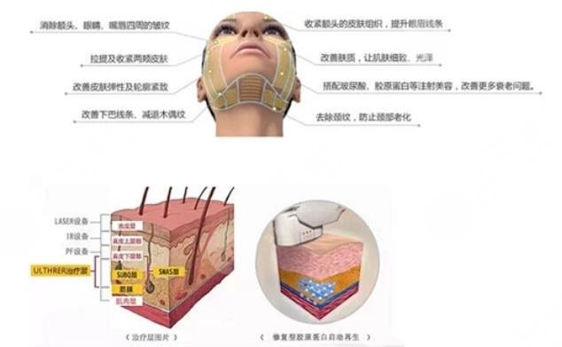 热玛吉是什么原理