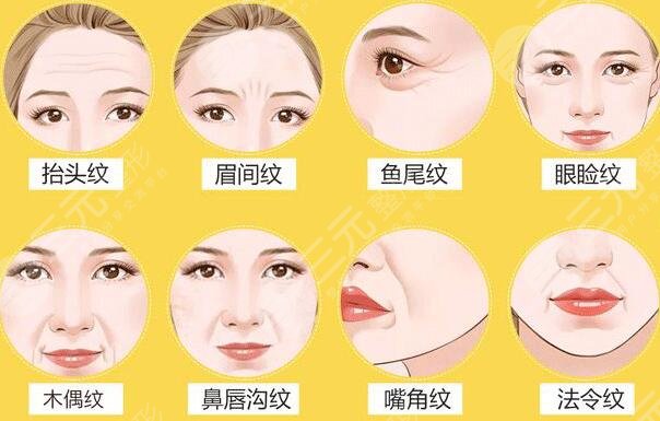西京医院微整形除皱