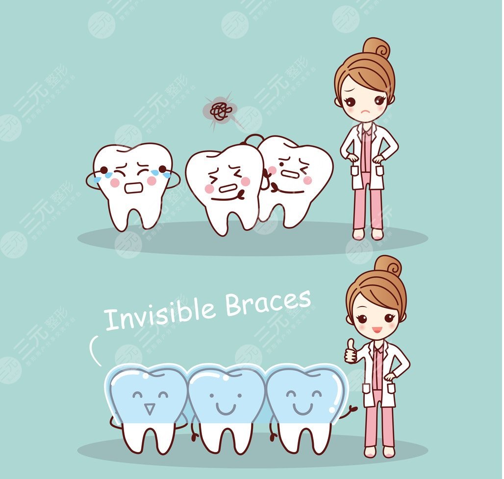 隐形正畸技术矫正牙齿后需要注意什么
