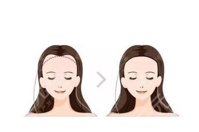 北京熙朵植发医院特色项目介绍