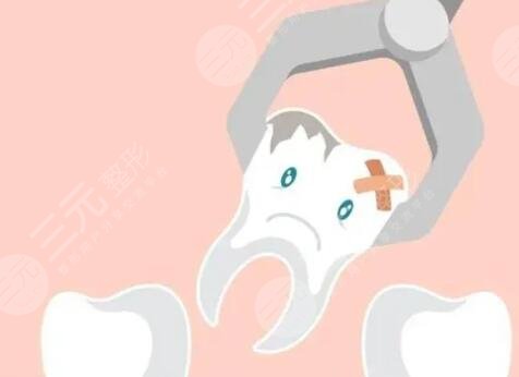 西安中诺口腔医院种植牙案例分享