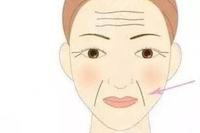 上海芮雅整形医院去抬头纹案例