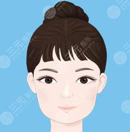 郑州二院割双眼皮案例