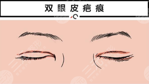 王义山整形好吗？双眼皮修复怎么样？医生简介+收费标准+坐诊医院
