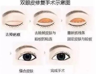 王义山医生擅长项目科普