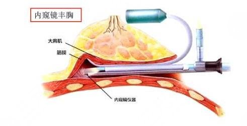 王义山医生擅长项目科普