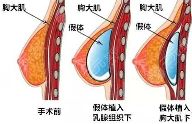英国娜高好还是美国曼托好